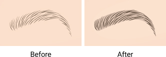 before after